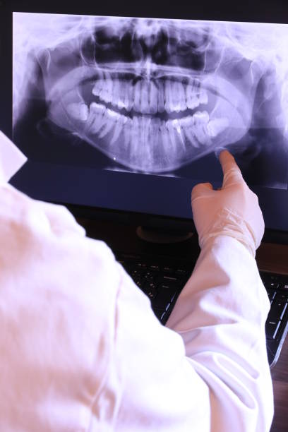 Best Walk-In Emergency Dental Services in Pleasant Hill, CA