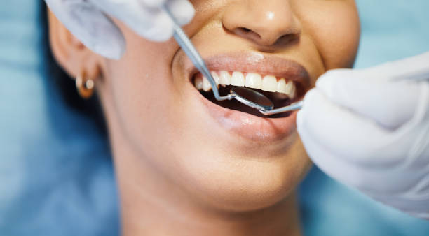 Best Walk-In Emergency Dental Services in Pleasant Hill, CA
